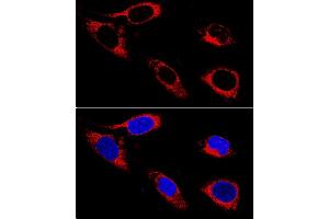 Confocal immunofluorescence analysis of U-2OS cells using P4HB antibody (ABIN3021093, ABIN3021094, ABIN3021095 and ABIN1513299) at dilution of 1:400.