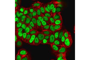 Immunofluorescence Analysis of PFA-fixed MCF-7 cells labeled with FOXA1 Mouse Monoclonal Antibody (FOXA1/1512) followed by goat anti- mouse IgG-CF488. (FOXA1 抗体  (AA 372-472))