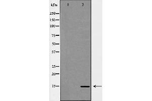 Western blot analysis of extracts of HeLa, using H3K14me3 antibody. (Histone 3 抗体  (H3K14me3))