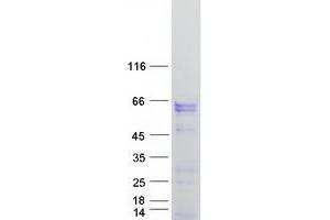 Validation with Western Blot