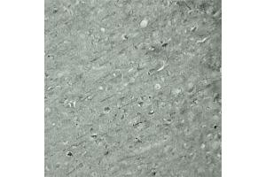 IHC on mouse brain (cryo section) using Rabbit antibody to Synaptotagmin 17  at a concentration of 50 µg/ml incubated overnight at 4C. (SYT17 抗体  (Internal Region))