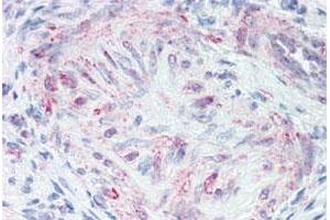 Immunohistochemical (Formalin/PFA-fixed paraffin-embedded sections) staining in human uterus, vessel with MLNR polyclonal antibody . (Motilin Receptor 抗体  (Cytoplasmic Domain))