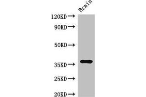 Western Blot Positive WB detected in: Mouse brain tissue All lanes: RNF126 antibody at 2. (RNF126 抗体  (AA 39-225))