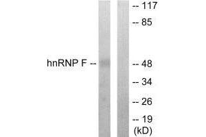 Western blot analysis of extracts from HepG2 cells, using hnRNP F antibody. (HNRNPF 抗体  (N-Term))