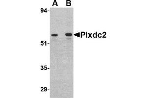 Western Blotting (WB) image for anti-Plexin Domain Containing 2 (PLXDC2) (C-Term) antibody (ABIN1030593) (PLXDC2 抗体  (C-Term))