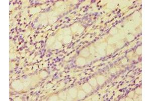 Immunohistochemistry of paraffin-embedded human colon tissue using ABIN7149359 at dilution of 1:100 (BMX 抗体  (AA 65-280))