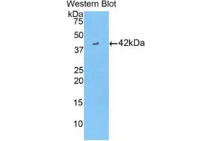 Western blot analysis of the recombinant protein. (CKB 抗体  (AA 11-367))