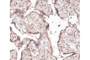 Immunohistochemistry of paraffin-embedded Human placenta using CCNE2 Polyclonal Antibody at dilution of 1:100 (40x lens). (Cyclin E2 抗体)