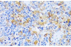 Immunohistochemistry of paraffin-embedded Rat spleen using AARS Polyclonal Antibody at dilution of 1:100 (40x lens). (AARS 抗体)