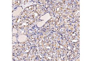 IHC analysis of HECTD1 using anti-HECTD1 antibody (ABIN7601584).