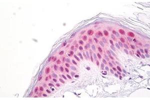 Anti-MP-44 / NUP53 antibody IHC staining of human skin, epidermis. (NUP35 抗体  (AA 50-100))