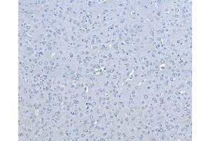 IHC analysis of B Raf/BRAF using anti-B Raf/BRAF antibody (ABIN3043761). (BRAF 抗体  (AA 38-230))