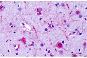 Anti-GPR75 antibody IHC staining of human brain, cortex, neurons. (GPR75 抗体  (Cytoplasmic Domain))