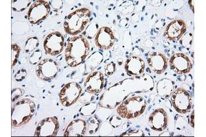 Immunohistochemical staining of paraffin-embedded Human Kidney tissue using anti-TTC32 mouse monoclonal antibody. (TTC32 抗体)