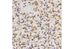 Immunohistochemistry (IHC) image for anti-Histone 3 (H3) (H3K36me2) antibody (ABIN3016036)