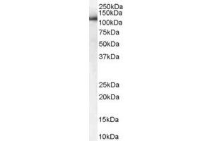 Western Blotting (WB) image for anti-USO1 Homolog, Vesicle Docking Protein (USO1) (AA 961-972) antibody (ABIN297849) (USO1 抗体  (AA 961-972))