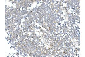 IHC analysis of DDIT3 using anti-DDIT3 antibody (ABIN7599026). (DDIT3 抗体  (AA 1-169))