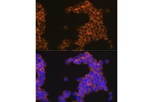 Immunofluorescence analysis of Jurkat cells using CD30 Rabbit mAb (ABIN7271072) at dilution of 1:100 (40x lens).