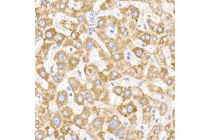 Immunohistochemistry of paraffin-embedded human liver using NDUFB9 Rabbit mAb (ABIN7268815) at dilution of 1:200 (40x lens). (NDUFB9 抗体)
