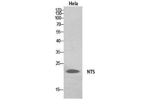 Western Blot (WB) analysis of HeLa, HepG2 cells using Neurotensin Polyclonal Antibody. (Neurotensin 抗体  (Internal Region))
