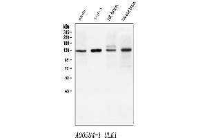 Western blot analysis of ULK1 using anti-ULK1 antibody (ABIN7602755).