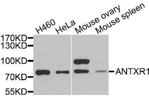 Western blot analysis of extracts of various cells, using ANTXR1 antibody. (ANTXR1 抗体)