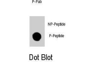 Dot blot analysis of GATA6 (phospho Y271) polyclonal antibody  on nitrocellulose membrane. (GATA6 抗体  (pTyr271))