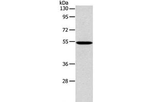 Western Blot analysis of 293T cell using ERG Polyclonal Antibody at dilution of 1:650 (ERG 抗体)