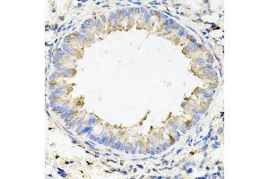 Immunohistochemistry of paraffin-embedded mouse lung using CALU antibody at dilution of 1:100 (x40 lens). (CALU 抗体)