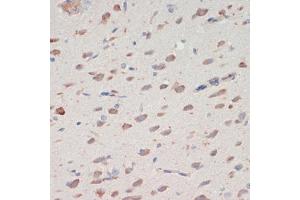 Immunohistochemistry (IHC) image for anti-serpin Peptidase Inhibitor, Clade I (neuroserpin), Member 1 (SERPINI1) (AA 181-410) antibody (ABIN7270251)