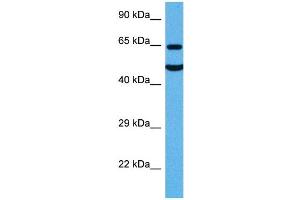Western Blotting (WB) image for anti-Solute Carrier Family 1 (Glial High Affinity Glutamate Transporter), Member 2 (SLC1A2) (N-Term) antibody (ABIN2778148)