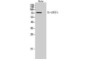 Western Blotting (WB) image for anti-Interleukin 12 Receptor beta 1 (IL12RB1) (Internal Region) antibody (ABIN3178960) (IL12RB1 抗体  (Internal Region))