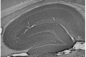 Adult rat hippocampus immunohistochemistry. (ANK2 抗体  (AA 203-496))