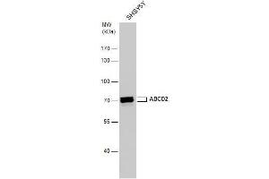 WB Image ABCD2 antibody detects ABCD2 protein by western blot analysis. (Abcd2 抗体)
