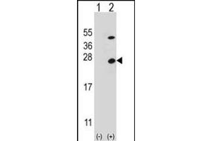 Western Blotting (WB) image for anti-ATP Synthase, H+ Transporting, Mitochondrial F1 Complex, O Subunit (ATP5O) (AA 38-64), (N-Term) antibody (ABIN652503)