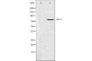 Western blot analysis of extracts from LOVO cells, using APBB2 antibody. (APBB2 抗体  (Internal Region))