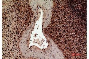 Immunohistochemistry (IHC) analysis of paraffin-embedded Human Spleen, antibody was diluted at 1:100. (HLA-DQ1/DQ2 抗体  (Internal Region))