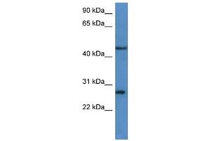 WB Suggested Anti-FGFBP2 Antibody Titration: 0. (FGFBP2 抗体  (C-Term))