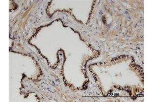 Image no. 1 for anti-Zinc Fingers and Homeoboxes 3 (ZHX3) (AA 863-955) antibody (ABIN599532) (ZHX3 抗体  (AA 863-955))