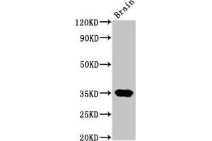 Western Blot Positive WB detected in: Rat brain tissue All lanes: NKX3-2 antibody at 4. (NKX3-2 抗体  (AA 1-333))