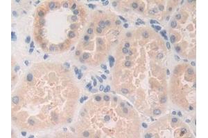 Detection of FDFT1 in Human Kidney Tissue using Polyclonal Antibody to Farnesyl Diphosphate Farnesyltransferase 1 (FDFT1)