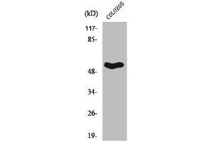 Western Blot analysis of COLO205 cells using Septin 1 Polyclonal Antibody (Septin 1 抗体  (Internal Region))