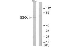 Western Blotting (WB) image for anti-Shugoshin 1 (SGOL1) (AA 271-320) antibody (ABIN2889634) (Shugoshin 抗体  (AA 271-320))