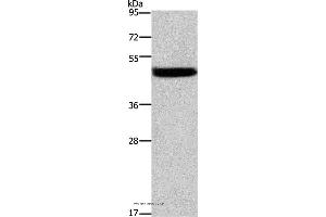 Western blot analysis of Mouse stomach tissue, using CTSE Polyclonal Antibody at dilution of 1:525 (Cathepsin E 抗体)