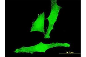 Immunofluorescence of monoclonal antibody to ACAN on HeLa cell. (Aggrecan 抗体  (AA 56-155))