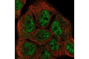 Immunofluorescent staining of A-431 cells using DUSP10 polyclonal antibody  shows positivity in nucleus (green) but excluded from the nucleoli. (DUSP10 抗体  (AA 180-291))