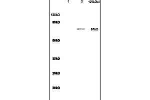 Lane 1: mouse heart lysates Lane 2: S/P20 Cell lysates probed with Anti IL-23R Polyclonal Antibody, Unconjugated (ABIN686857) at 1:200 in 4 °C. (IL23R 抗体  (AA 401-550))