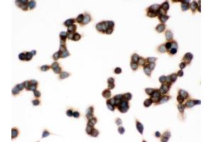 Immunohistochemistry (IHC) image for anti-Chaperonin Containing TCP1, Subunit 4 (Delta) (CCT4) (AA 452-539) antibody (ABIN4886514)