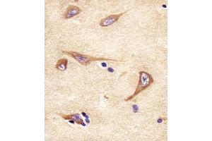 (ABIN652309 and ABIN2841413) staining NPTX1 in human brain tissue sections by Immunohistochemistry (IHC-P - paraformaldehyde-fixed, paraffin-embedded sections). (NPX1 抗体  (AA 322-350))