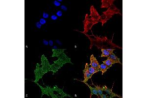 Immunocytochemistry/Immunofluorescence analysis using Rabbit Anti-ULK1 Polyclonal Antibody . (ULK1 抗体  (AA 567-577) (FITC))